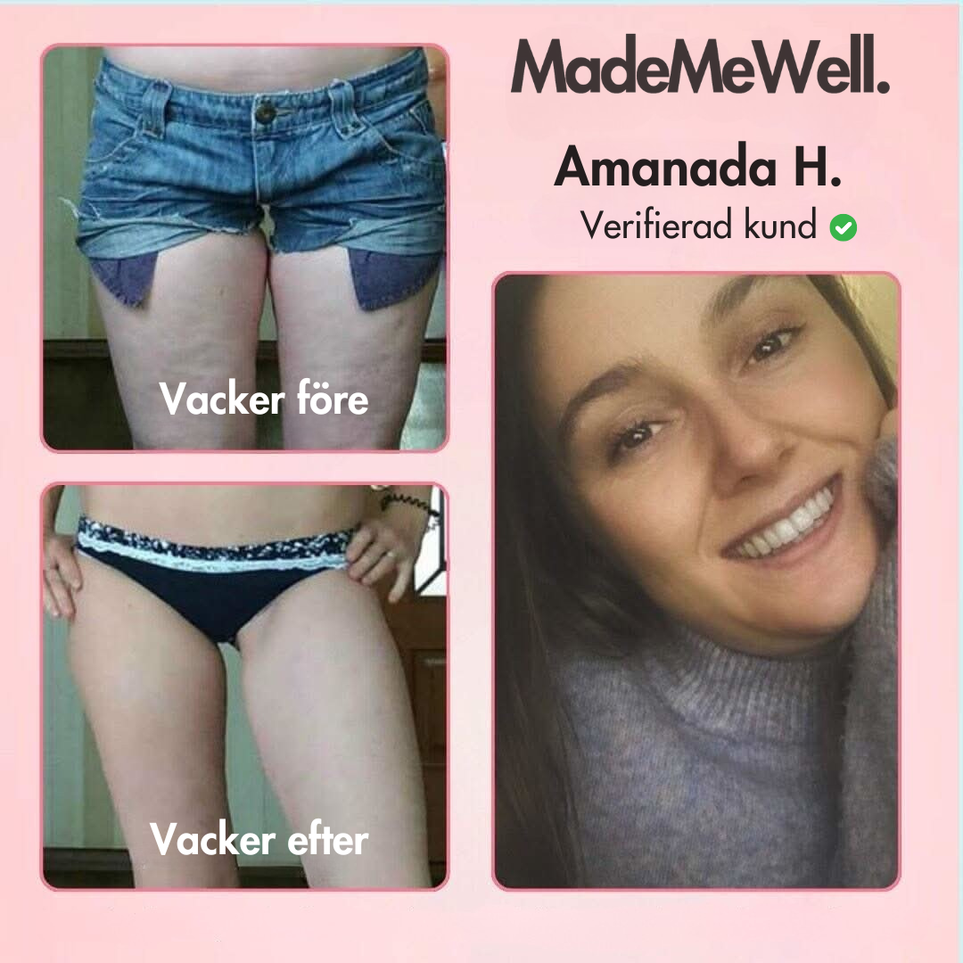 MMW Cellulite Relief™